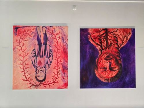 Otwarcie wystawy Zrosty na koniuszku serca