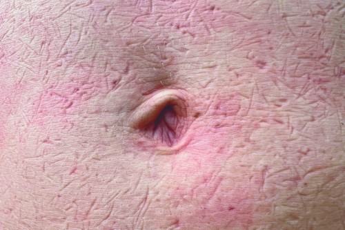 Zuzanna Dyrda, Ciało obce